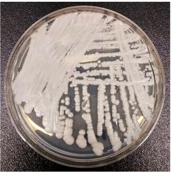 Deadly Fungus C. auris Spreading Across U.S., Detected in MI, IN, & OH